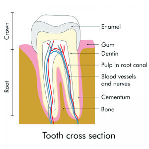 root canal