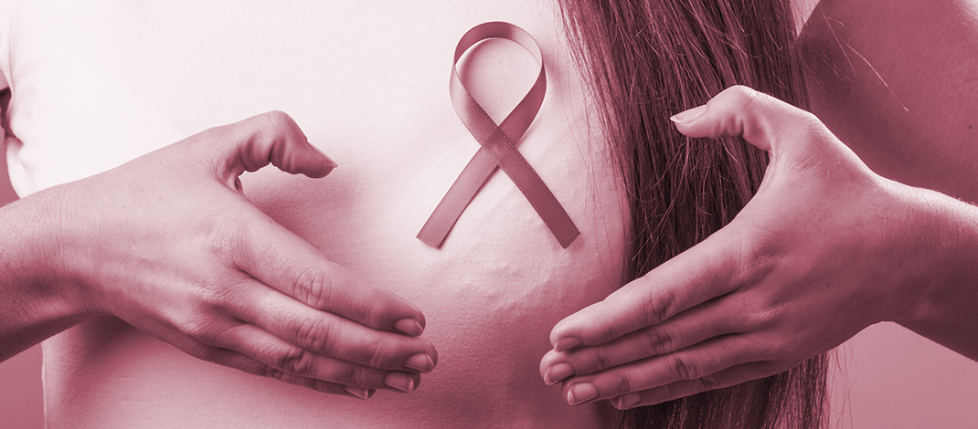 breast cancer