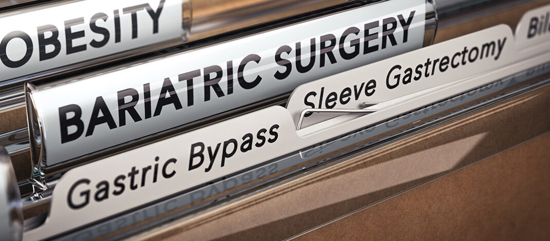 Weight Loss Surgeries Fall More Than 20% as Patients Turn to GLP-1 Meds, Experts Say