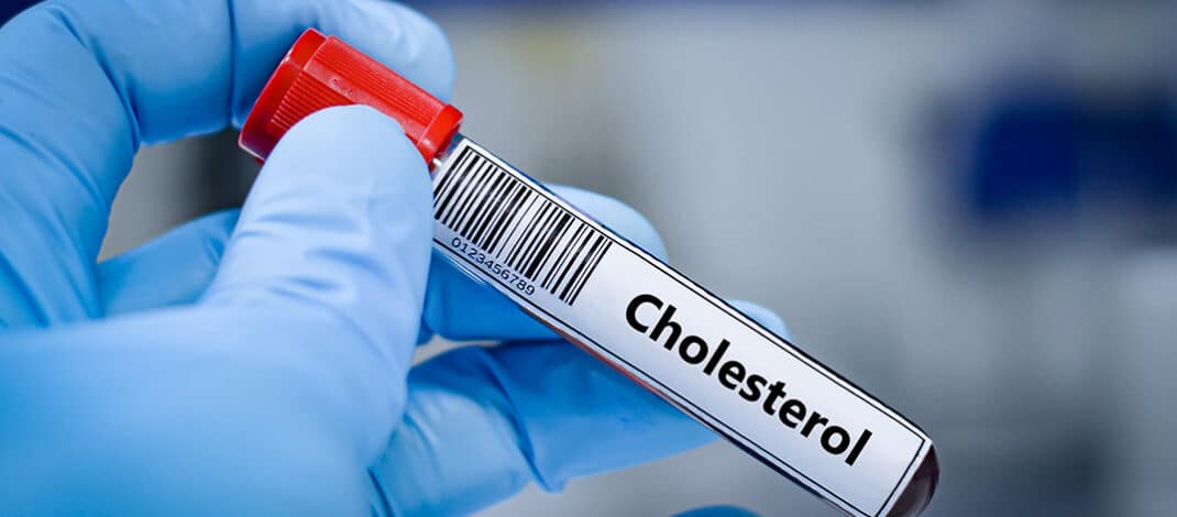 FDA Clears First Cholesterol Pill to Rival Costly Injections